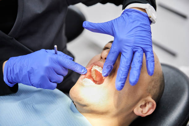 Best Emergency Dentist for Lost Fillings or Crowns in Cedar Ridge, CA