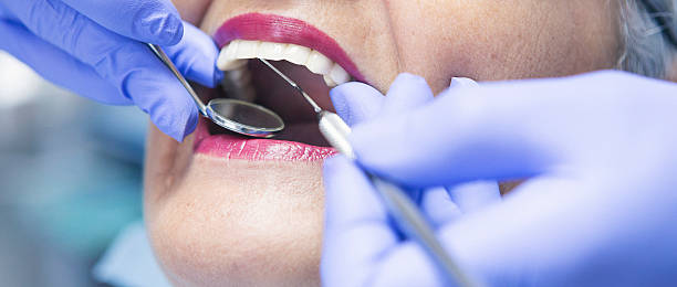 Best Mobile Emergency Dentist in Cedar Ridge, CA